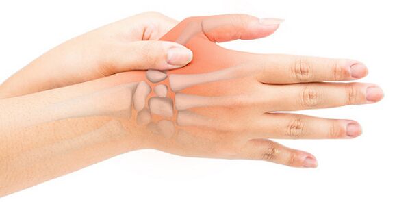 A ligamentite estenosante bloquea o dedo nunha posición flexionada