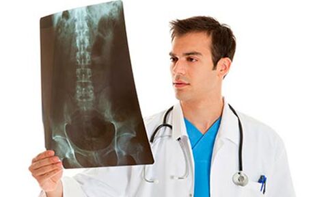 médico mirando radiografías para diagnosticar dor lumbar